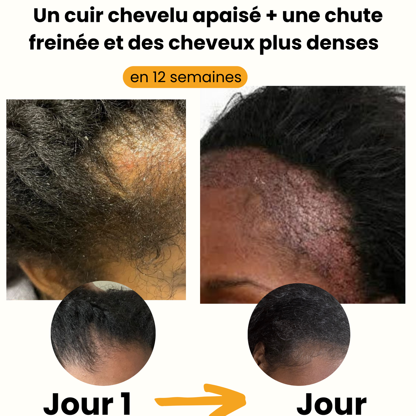 L'huile de batana 100% pure et non raffinée