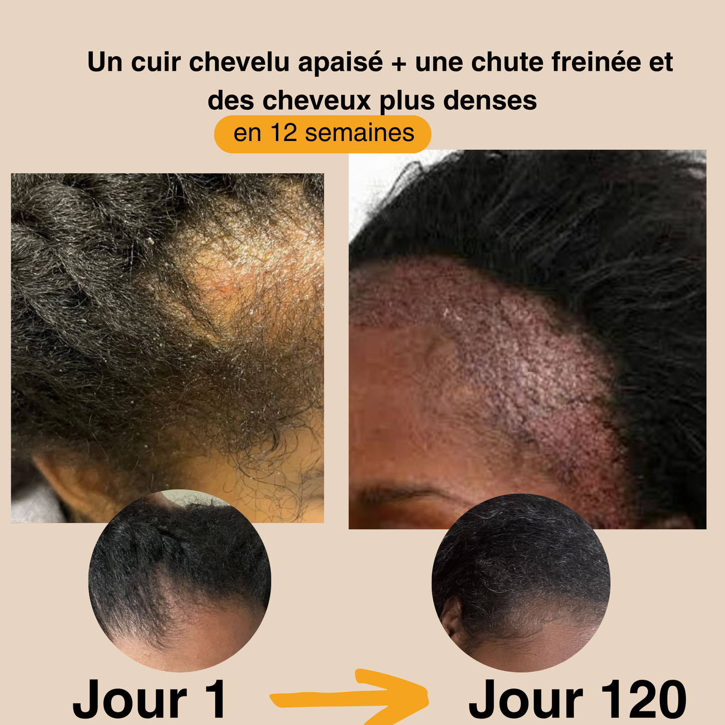 L'huile de batana 100% pure et non raffinée