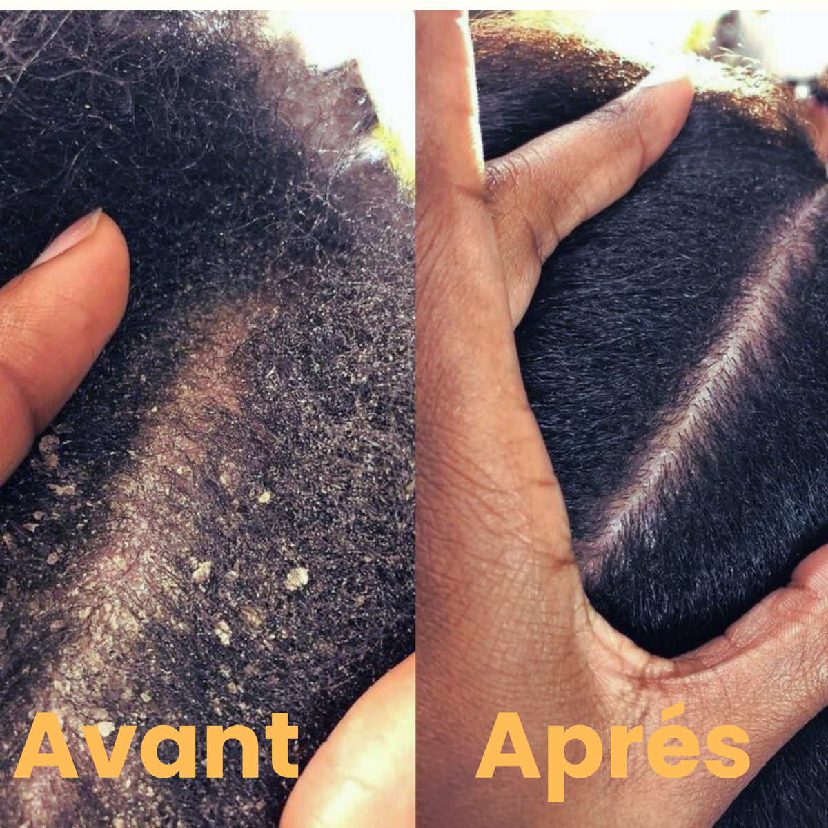 L'huile de batana 100%  pure et non raffinée