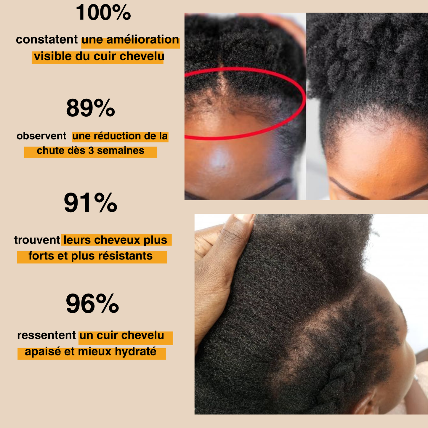 L'huile de batana 100%  pure et non raffinée