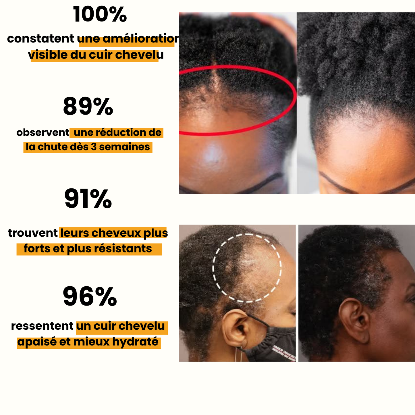 L'huile de batana 100%  pure et non raffinée