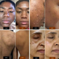 Savon noir africain clarifiant 3 en 1
