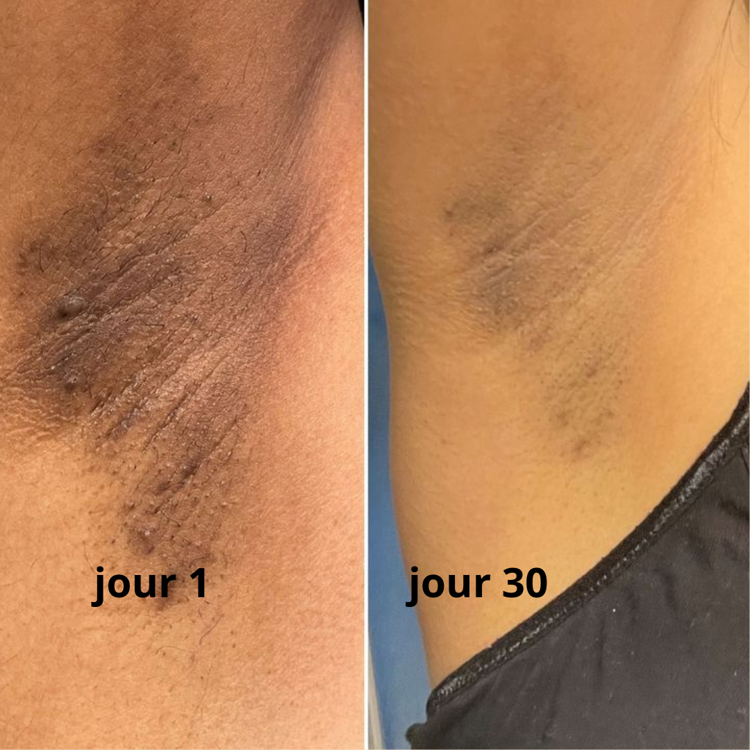 Poudre Éclaircissante Naturelle de Nila