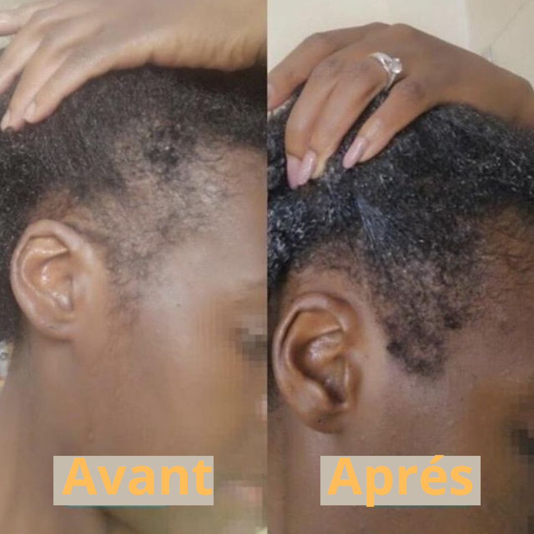 <p>Avant / Après</p>